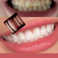 ارائه خدمات دندانپزشکی با تخفیف ویژه