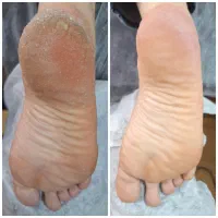 پدیکور تخصصی و کفسابی پا برای خانم ها