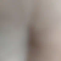 خط داعم رند