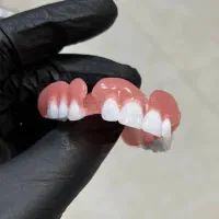 دندان مصنوعی/دنچر متحرک/روکش/پروتز دندان