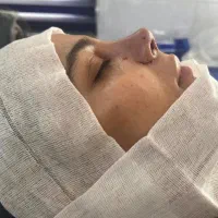بینی|خدمات زیبایی و سلامت|دهدشت, |دیوار