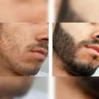مو و ریشت رو طبیعی پرپشت کن
