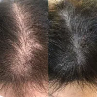 هربار درمانتو با یک روش جدید شروع می‌کنی