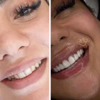 کلینیک نخصصی کامپوزیت دندان تمام اقساط در شیراز