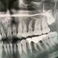 استخدام نرس و پذیرش دندانپزشکی