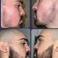 ریش داری یعنی ابهت داری