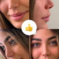 عمل جراحی بینی/ متخصص(ENT)/لیفت صورت|خدمات زیبایی و سلامت|کرج, جهان‌شهر|دیوار