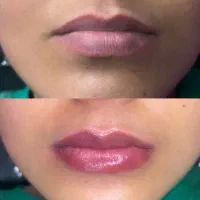 شیدینگ لب|خدمات آرایشگری و زیبایی|گرگان, |دیوار