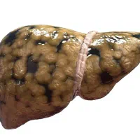 خستگی، تلخی دهان و بی‌حالی کبدت را جدی بگیر
