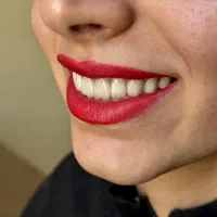 دندانپزشکی تخصصی و تضمینی دکتر قشقایی