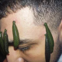 حجامت تخصصی اصفهان فصد پیشانی زالو غلظت واریس دیسک