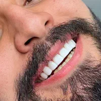 دندان|خدمات آرایشگری و زیبایی|نهاوند, |دیوار