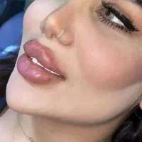 فیلر ،ژل ،بوتاکس و پی آر پی و اسکار صورت