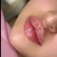 جشنواره ویژه زیبایی فیلر و بوتاکس