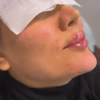 خدمات زیبایی