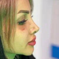بینی|خدمات زیبایی و سلامت|دهدشت, |دیوار