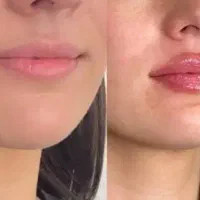 درمان بیماری پوست ومو و زیبایی توسط پزشک پوست
