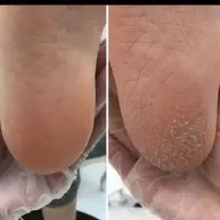 پدیکور ۳۵۰تومان