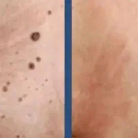 گوشت های اضافه بدنت رو پاک کن تو ۳ روز