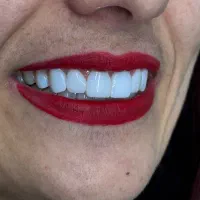 کامپوزیت با شرایط اقساط