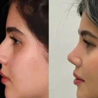 عمل بینی