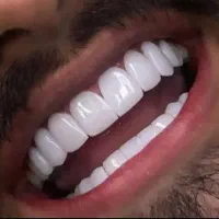 دندانپزشکی جشنواره ویژه بهار