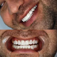 کامپوزیت دندان|خدمات آرایشگری و زیبایی|تهران, هفت حوض|دیوار