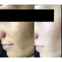 قرص روشن کننده پوست صورت و بدن پیگمنتا