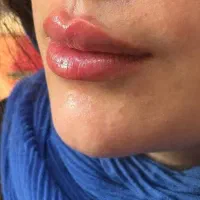 آموزش دوره های زیبایی و تزریقات