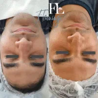 فیشال در مطب پزشک