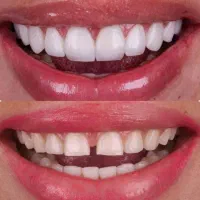 جشنواره بزرگ دندانپزشکی/تخفیف واقعی/بالاترین کیفیت