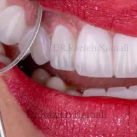 دندانپزشکی اقساطی در فلاورجان و اصفهان