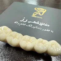دندان مصنوعی/روکش/کامپوزیت/اقساط