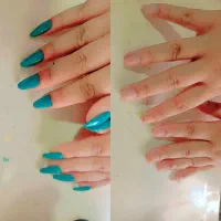 کاشت ناخن