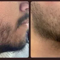 ریش باید کامل باشه نه اینکه کچل باشه