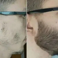 قطعا ریش نشونه مردونگیه
