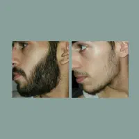 ریشو باش|آرایشی، بهداشتی، درمانی|سیرجان, |دیوار