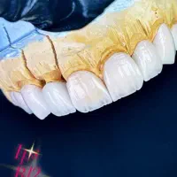 به یک شاگرد جهت کار در لابراتوار دندانسازی