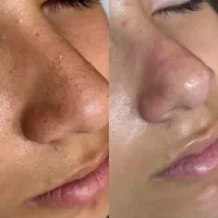 مدل فیشال فقط با پرداخت هزینه ی مواد
