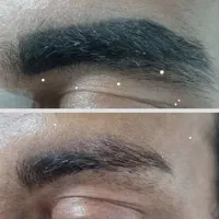 پاک کردن تخصصی تاتو بدون موندن جایی تضمینی