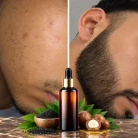 طولی نمیکشه تا پرپشت بشه