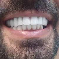 خدمات درمانی دندانپزشکی