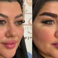مدل میکروکاشت ۸۵۰۰