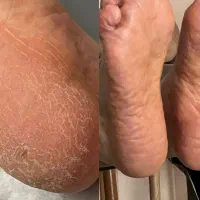 آفر ویژه خدمات و آموزش پدیکور خیس و استتیک روسی