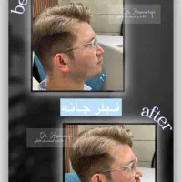 دکتر حسان عارفی  بوتاکس فیلر و طراحی چهره