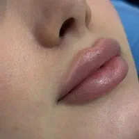 خدمات ژل و بوتاکس