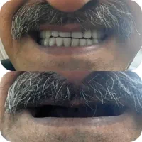 لابراتور دندان سازی آریا ( یزد )