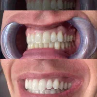 خدمات دندانپزشکی با بهترین متریال و کمترین هزینه