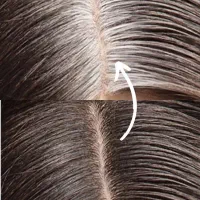سریعترین راهکار رفع دائمی سفیدی مو