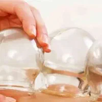 آموزش بادکش گرم ویژه بانوان‌